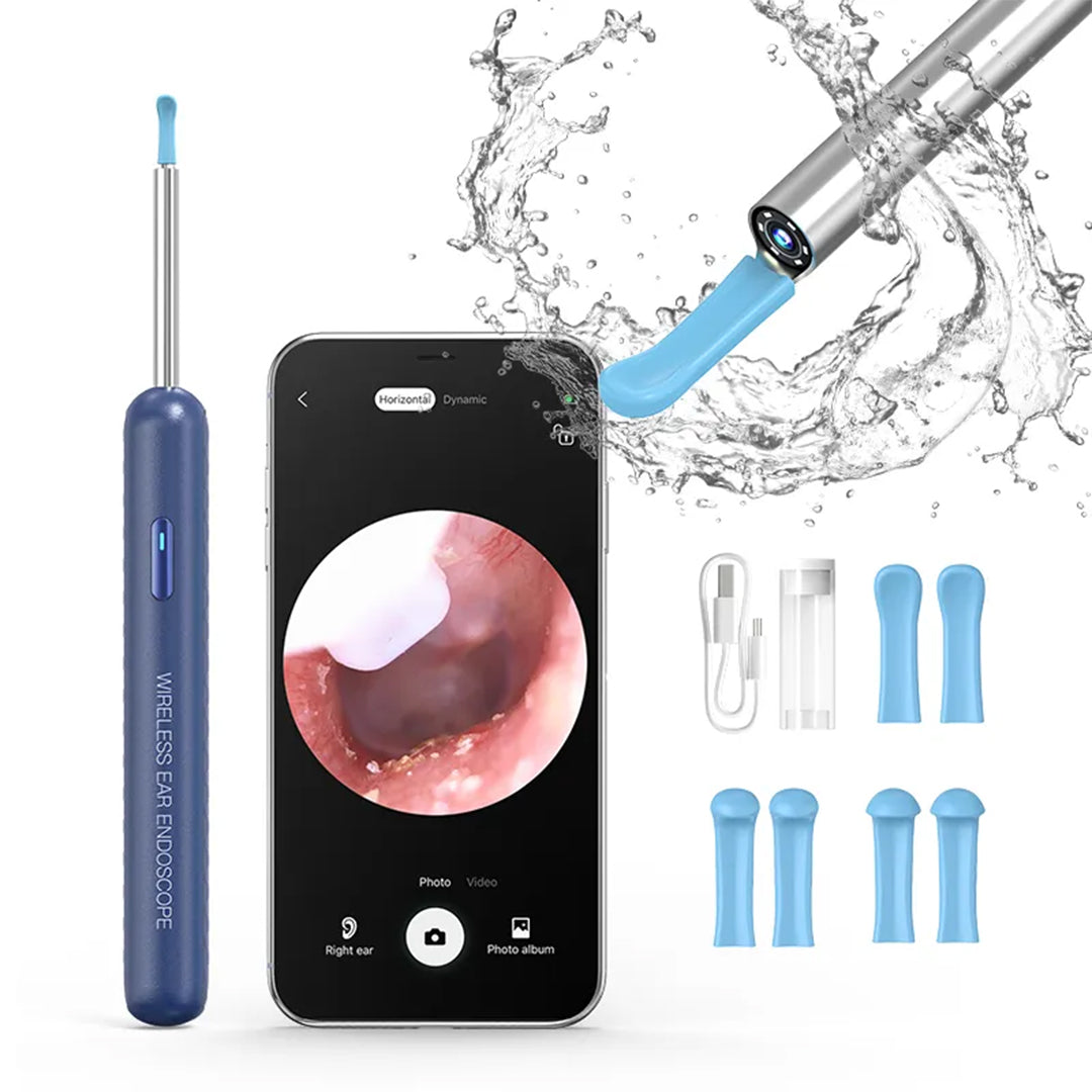 TecMarx Ear Cleaner | Endoscope 5 MP HD Camera | 4.3mm Lens | Brigthtest Light